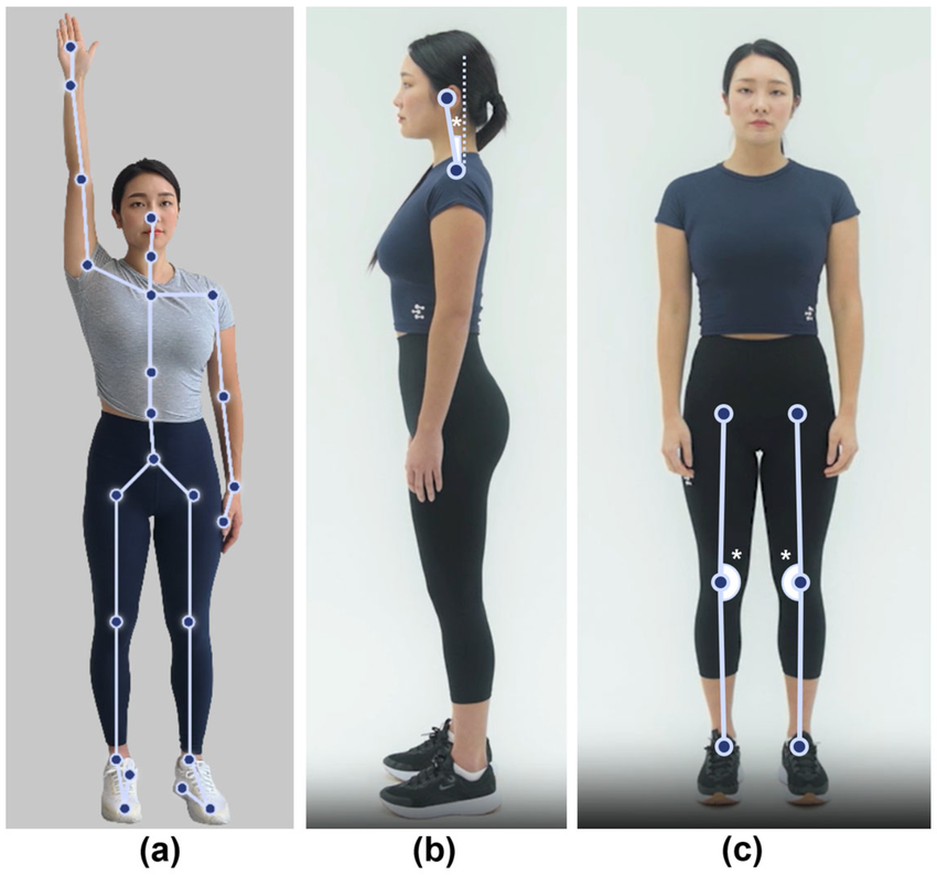 AI-Based Posture Assessment